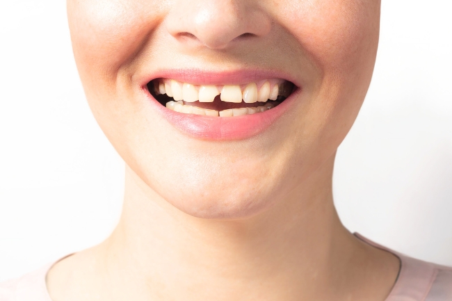 Sonhar com dente quebrado: 5 interpretações urgentes que você deve saber