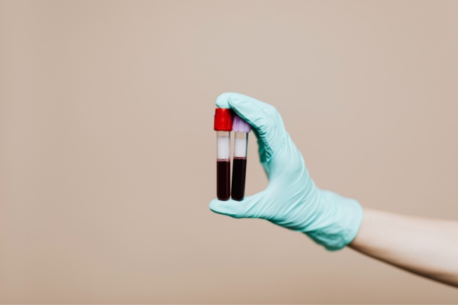 Sonhar com sangue: 5 significados profundos que exigem sua atenção