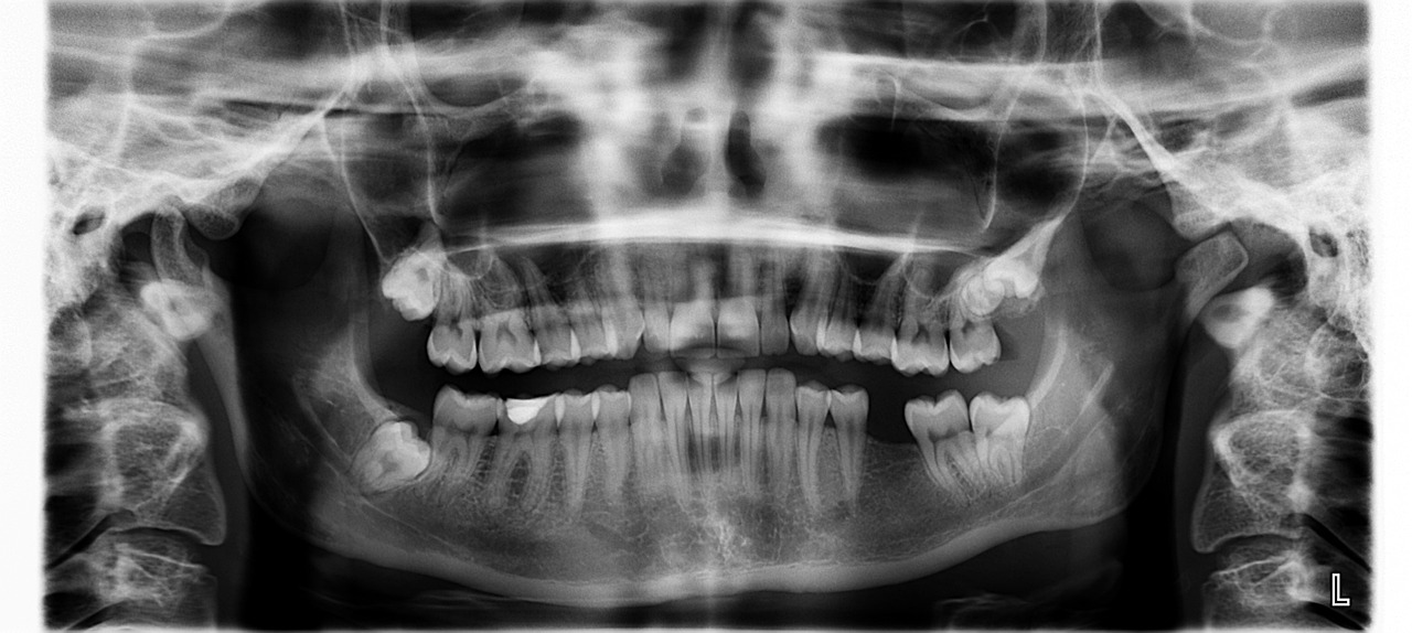 Sonhar com dor de dente: 5 significados que alertam para problemas urgentes