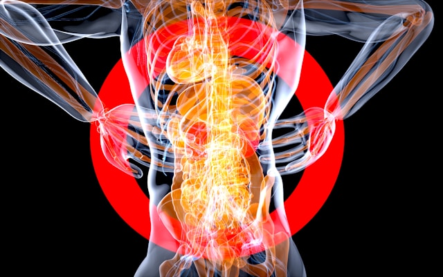 Quais os primeiros sintomas de um tumor na coluna? Descubra agora