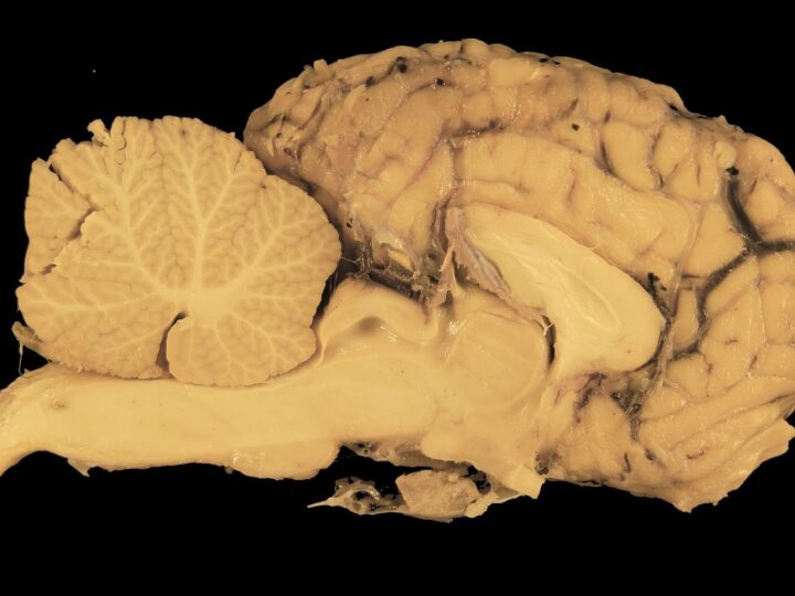 Lado direito do cérebro: funções e importância