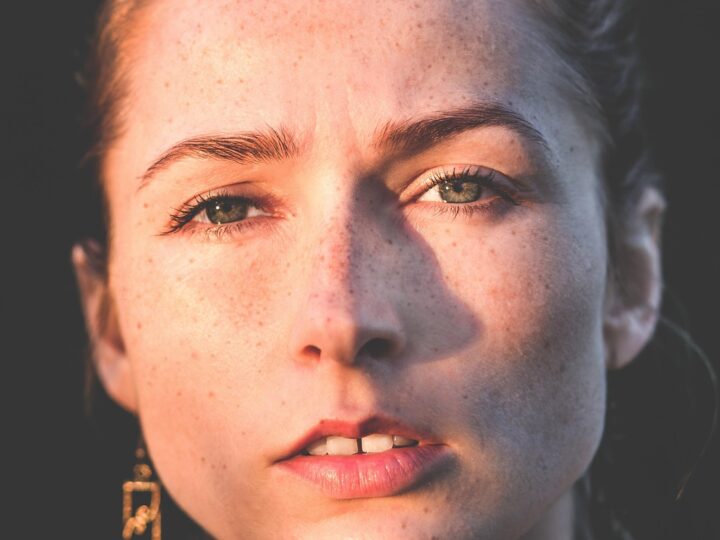 Mulher calva: causas, tipos e tratamentos